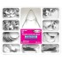 Метални седловидни матрици Saddle Metal Matrices Universal Kit 1.330 - TOR VM
