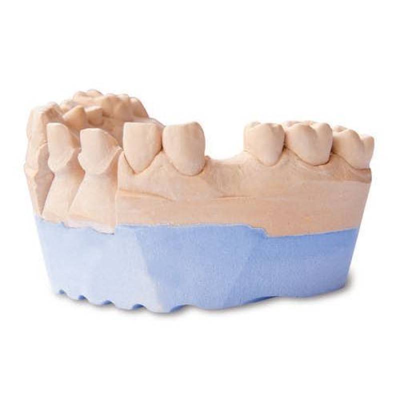 Гипс Denstone blue клас III