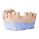 Гипс Denstone blue клас III